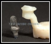 Encerado del Casquillo Ceramizado - Laboratorio Protesis Dentales Jacobo Chicheri